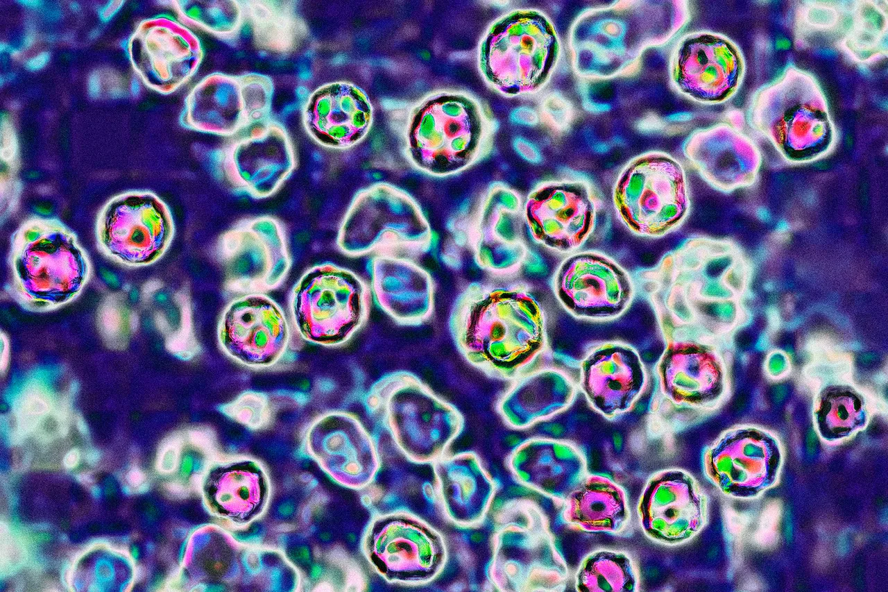 transmission microscopy image of the measles virus