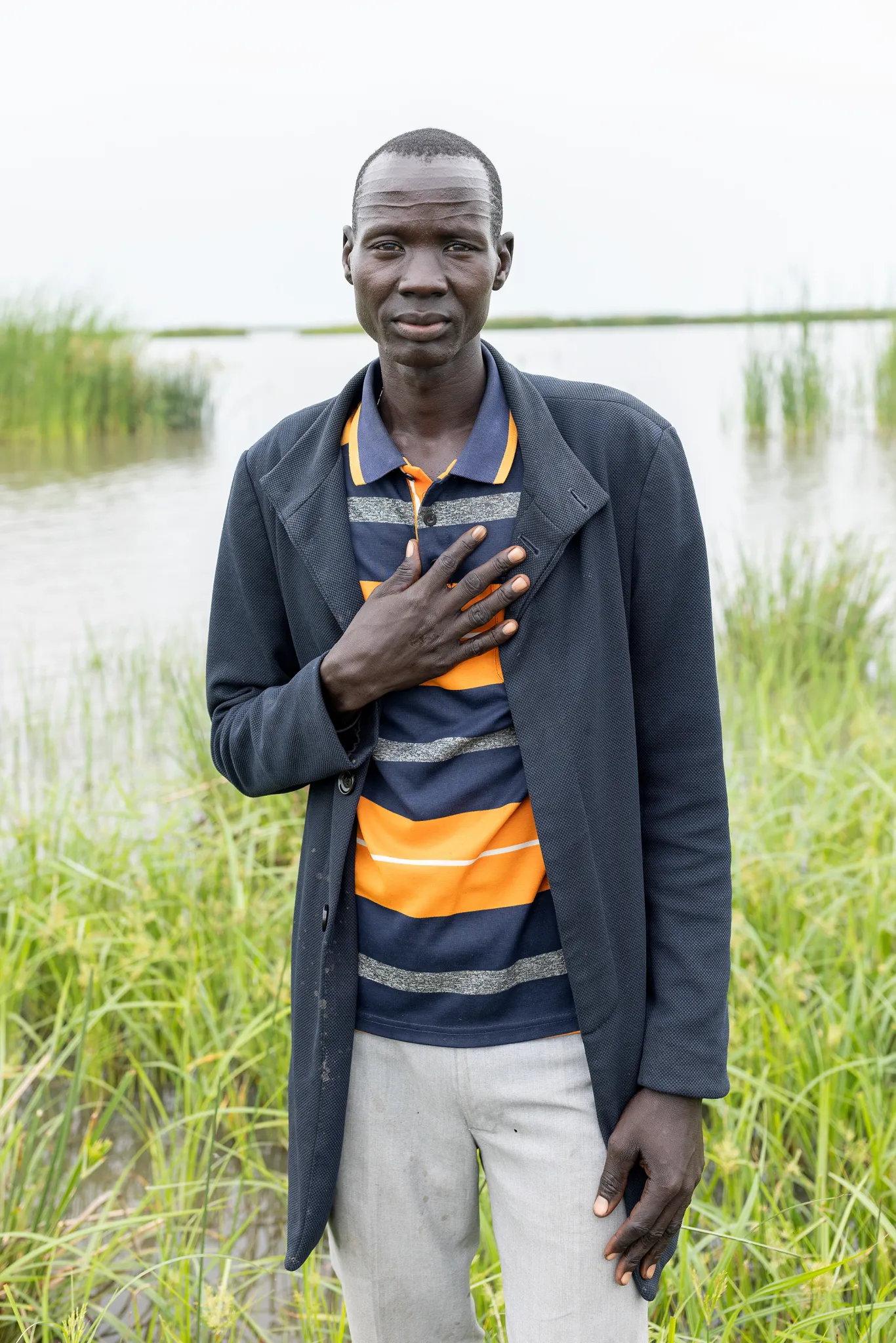 Tor Top, 38, lives with his family in a remote island community, where the only health clinic is funded by the U.S.