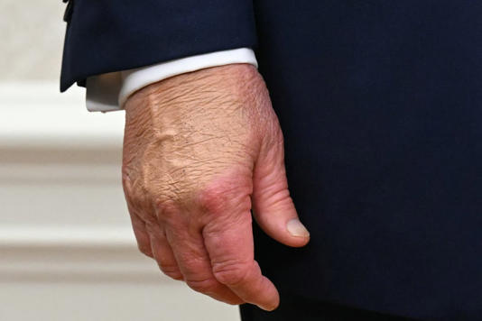 Trump hand