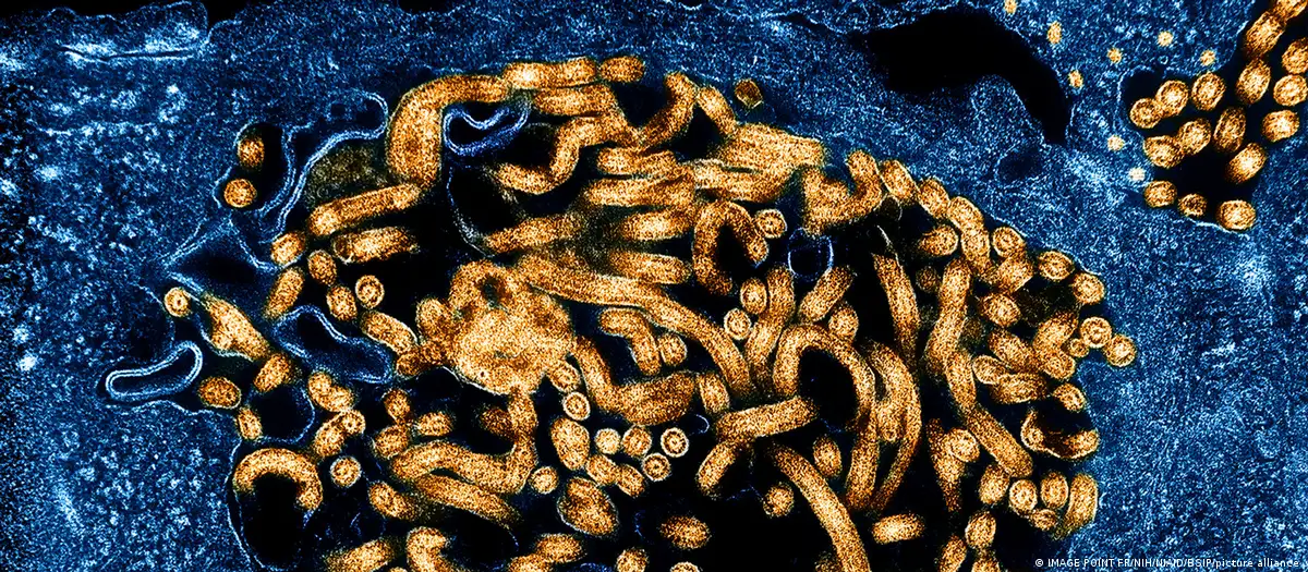 Ebola, which is believed to have originated in bats, can cause severe bleeding and organ failureImage: IMAGE POINT FR/NIH/NIAID/BSIP/picture alliance